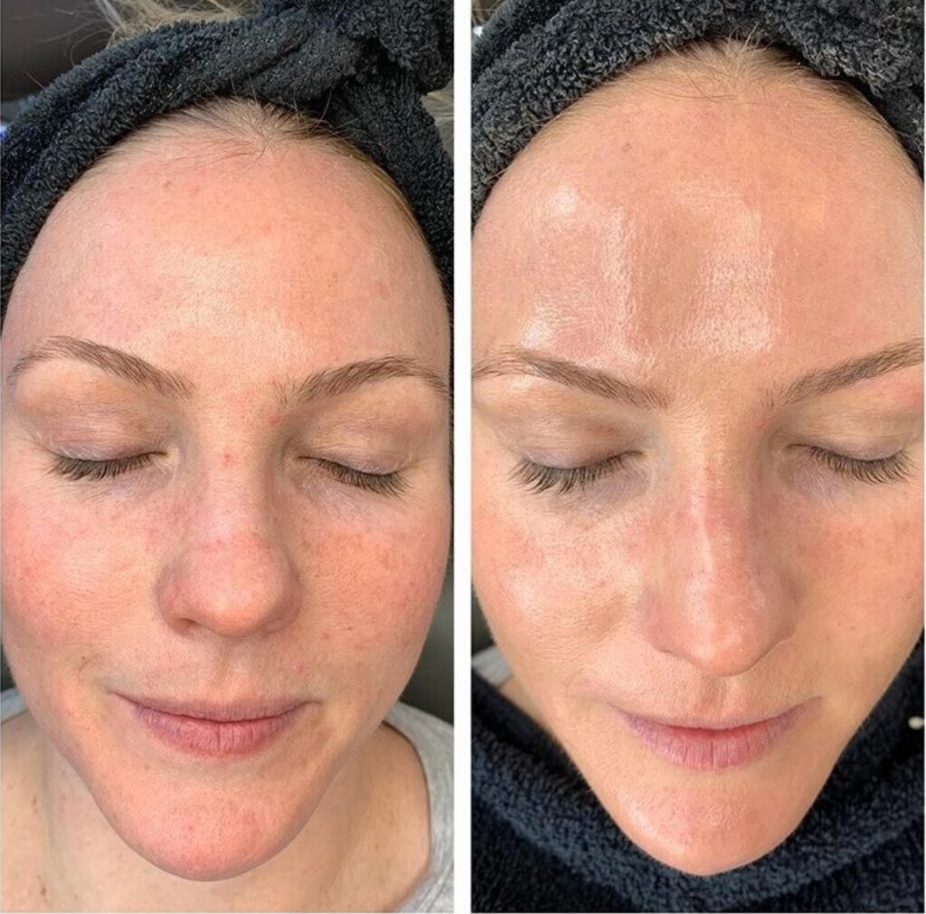 Facial to Hydrate – Replenish and restore