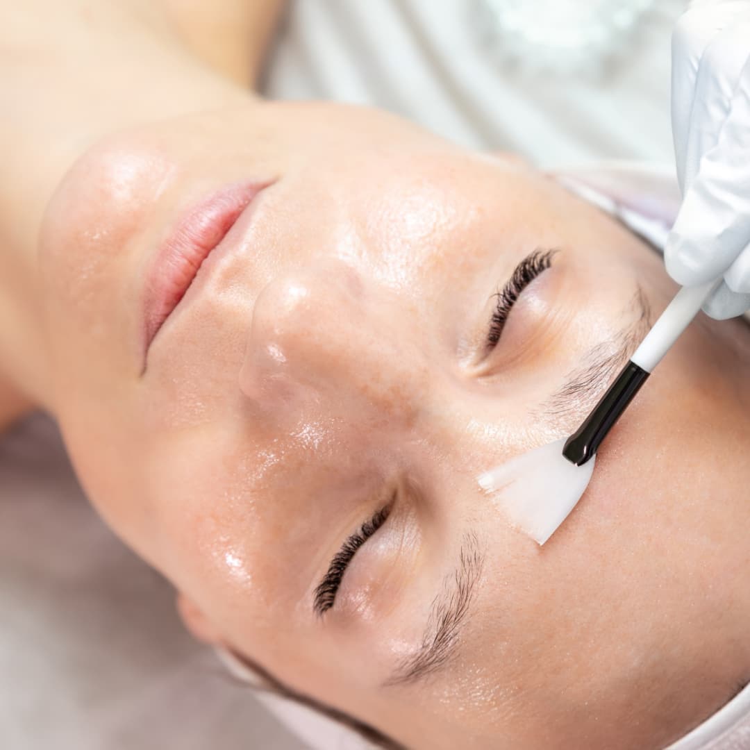 Revealing Radiance: Experience the Magic of Obagi Blue Radiance Peel