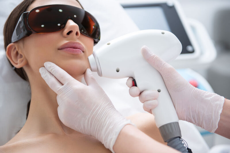 Face laser hair removal